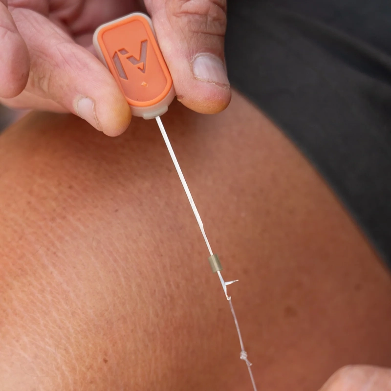 OMC N-Range Fine Splicing Needle